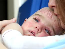   تخمین وجود 3 میلیون بیمار نادر در کشور